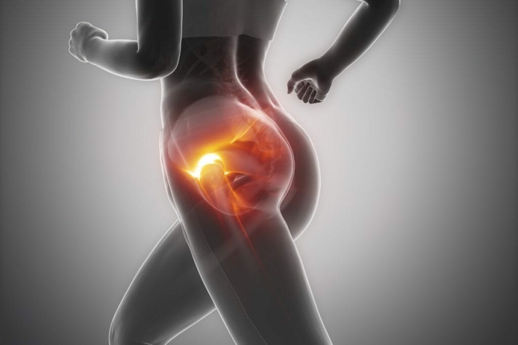 Hip Abductors - What are they & how do I strengthen them?